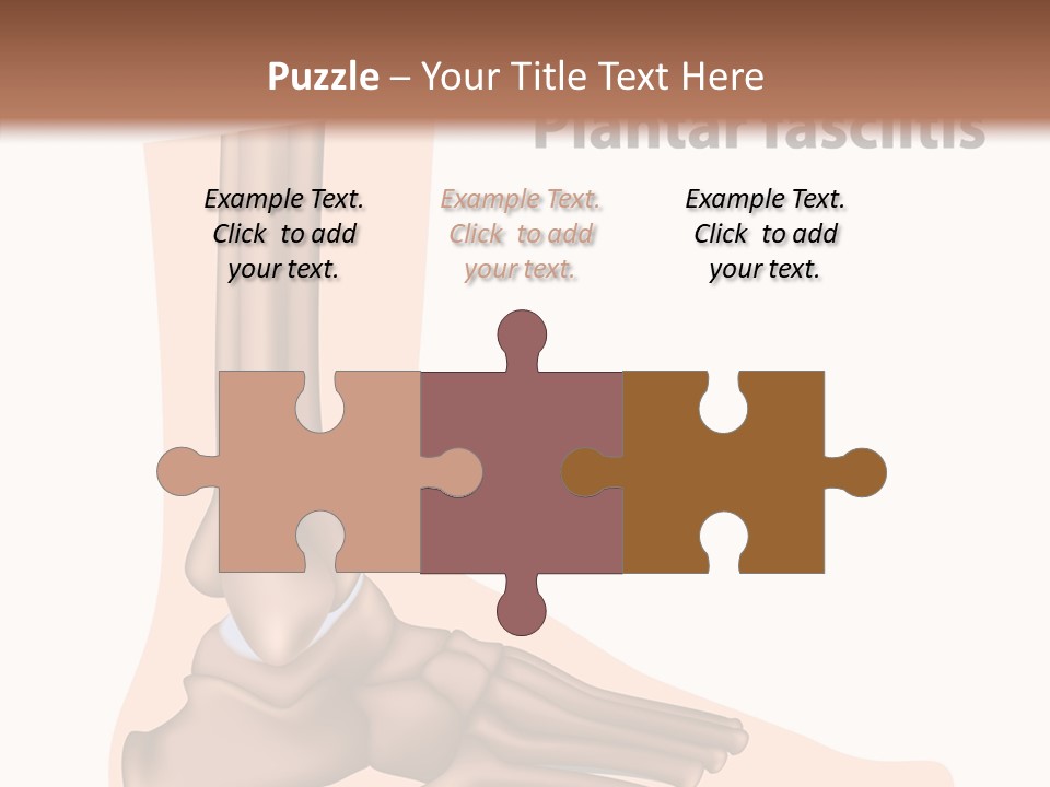 Problem Fibula Ankle PowerPoint Template