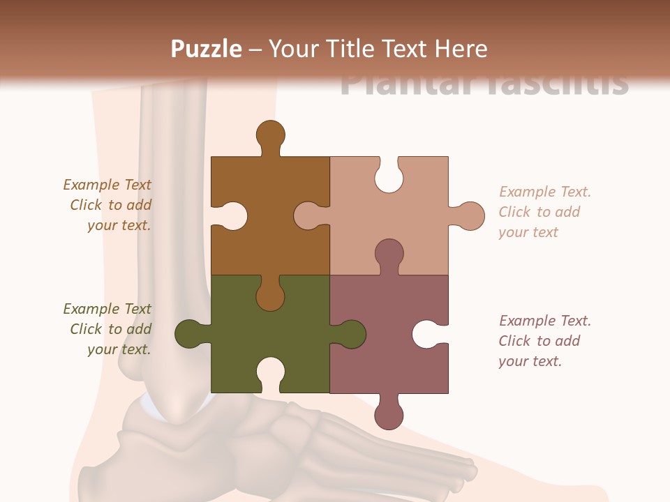 Problem Fibula Ankle PowerPoint Template