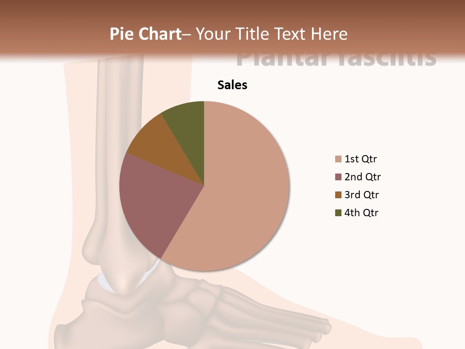Problem Fibula Ankle PowerPoint Template
