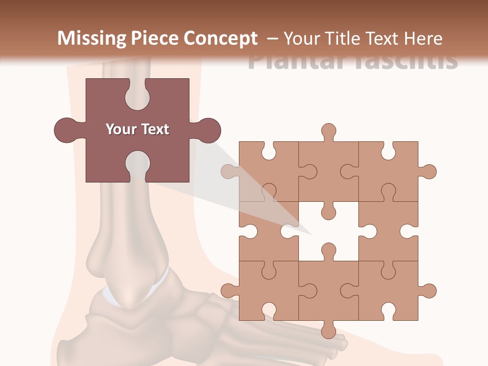 Problem Fibula Ankle PowerPoint Template