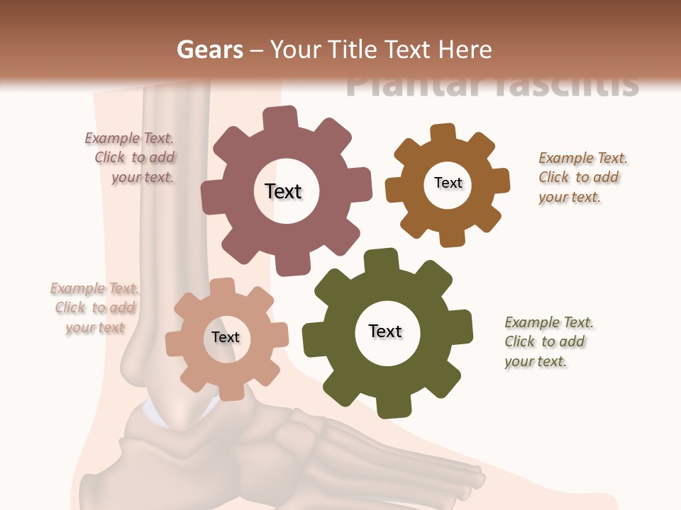 Problem Fibula Ankle PowerPoint Template