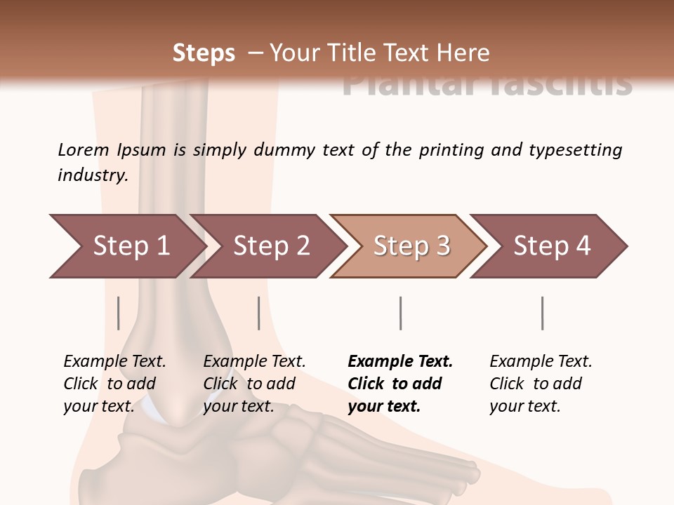 Problem Fibula Ankle PowerPoint Template