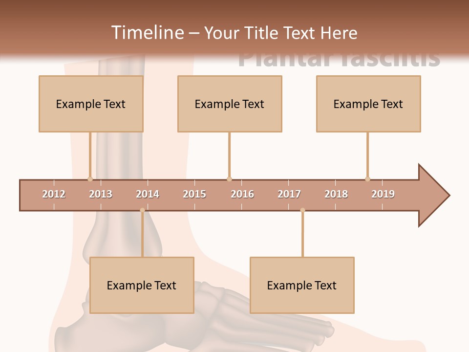 Problem Fibula Ankle PowerPoint Template