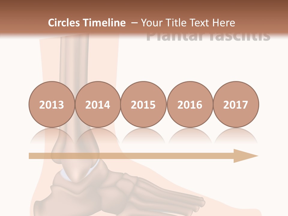 Problem Fibula Ankle PowerPoint Template