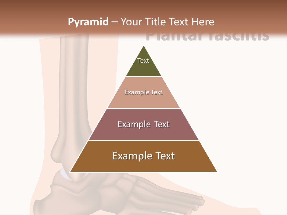 Problem Fibula Ankle PowerPoint Template