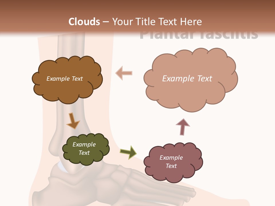 Problem Fibula Ankle PowerPoint Template