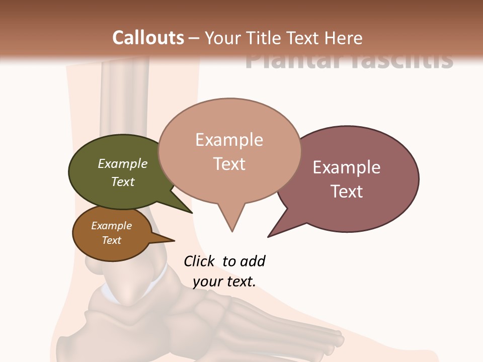 Problem Fibula Ankle PowerPoint Template