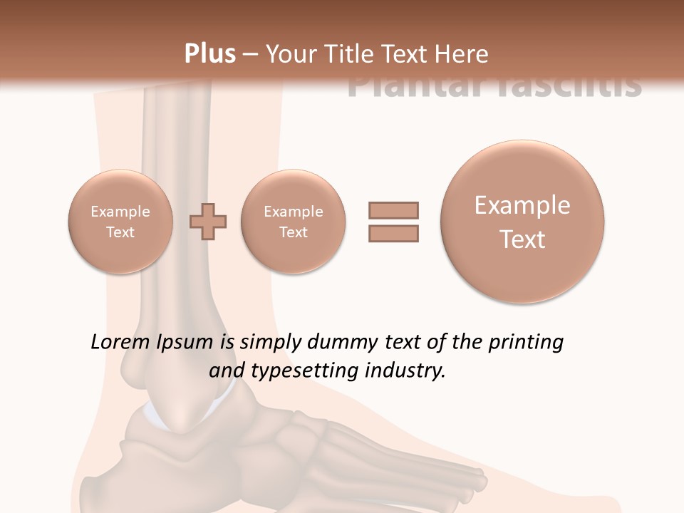 Problem Fibula Ankle PowerPoint Template
