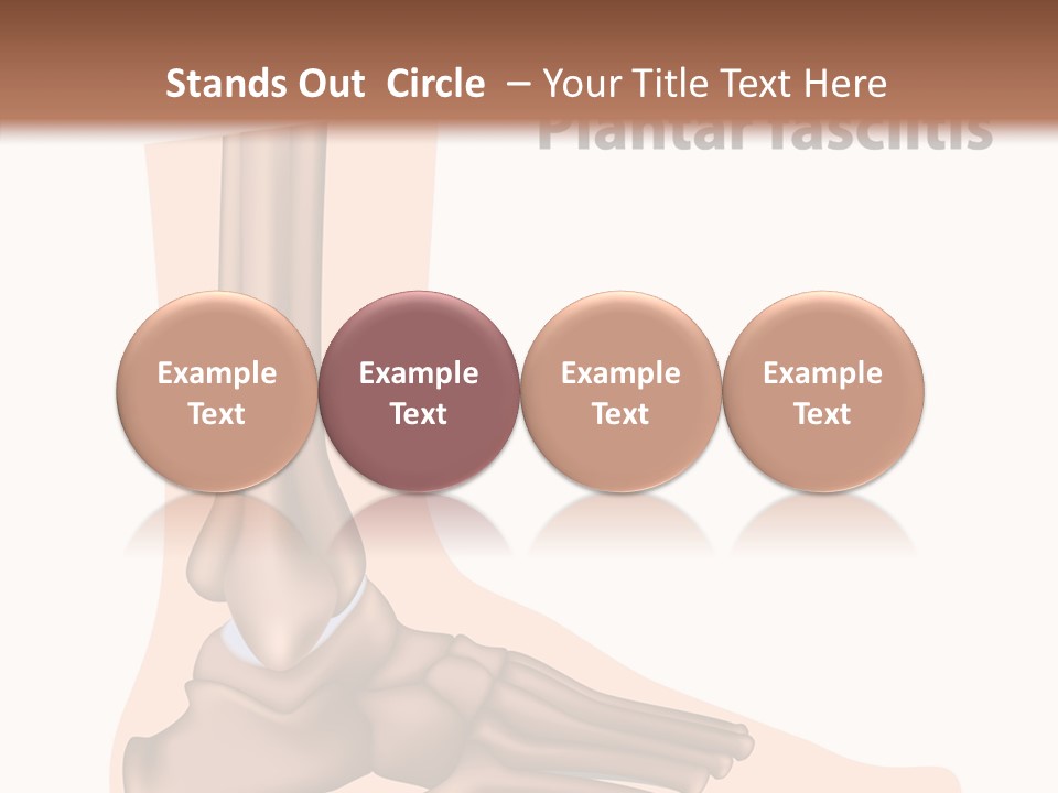 Problem Fibula Ankle PowerPoint Template