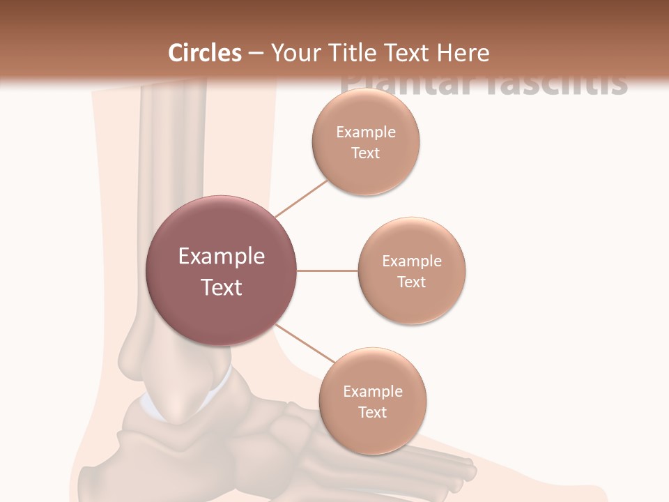 Problem Fibula Ankle PowerPoint Template