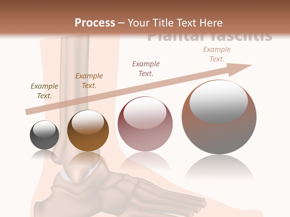 Problem Fibula Ankle PowerPoint Template