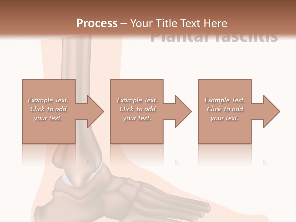 Problem Fibula Ankle PowerPoint Template