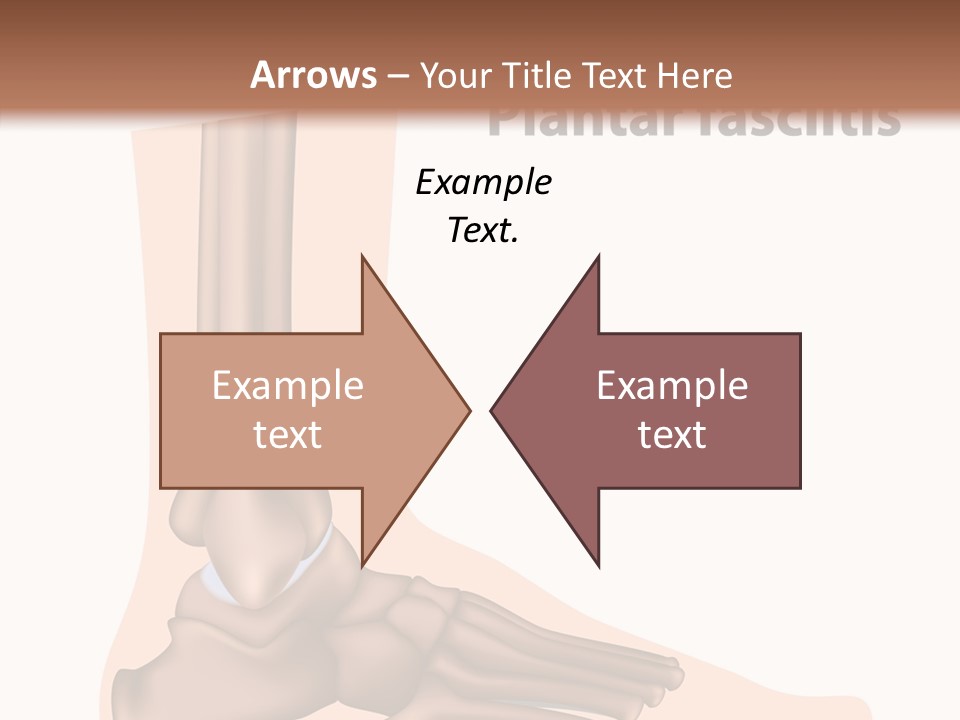 Problem Fibula Ankle PowerPoint Template