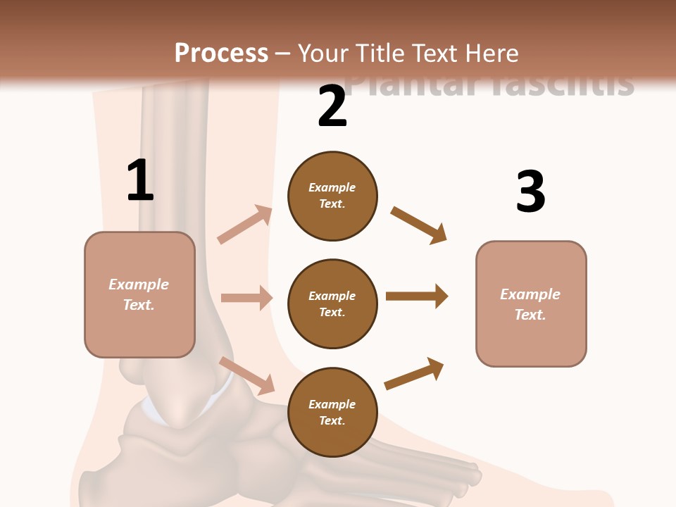 Problem Fibula Ankle PowerPoint Template