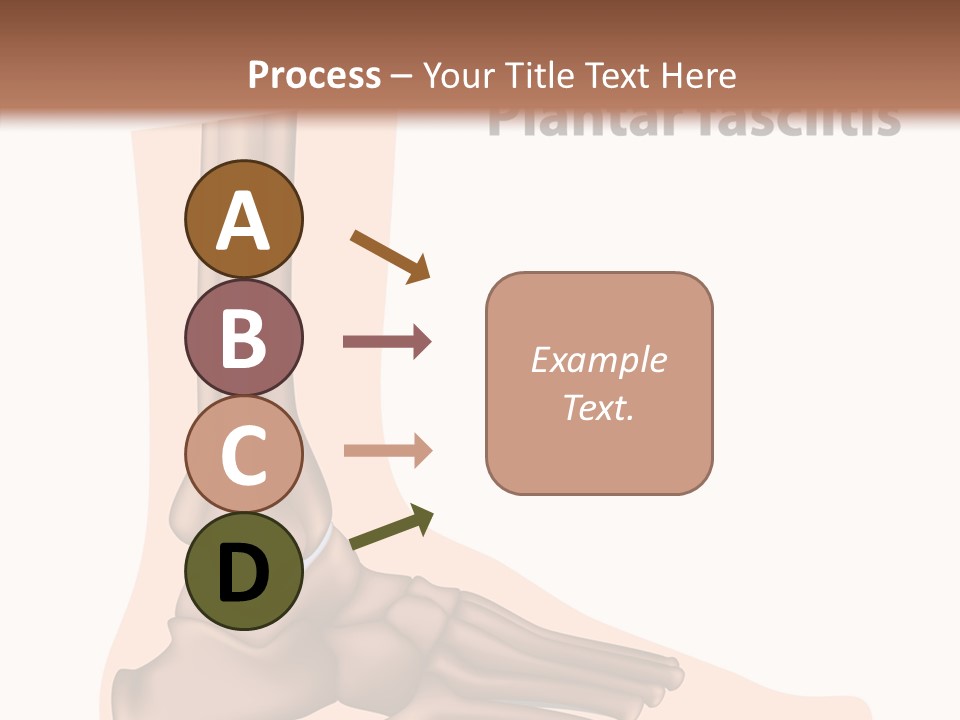 Problem Fibula Ankle PowerPoint Template
