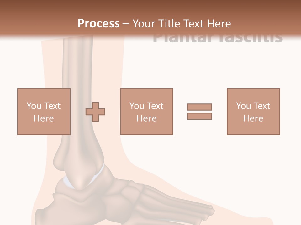 Problem Fibula Ankle PowerPoint Template