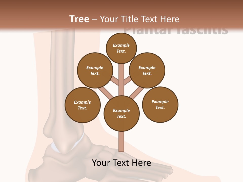 Problem Fibula Ankle PowerPoint Template