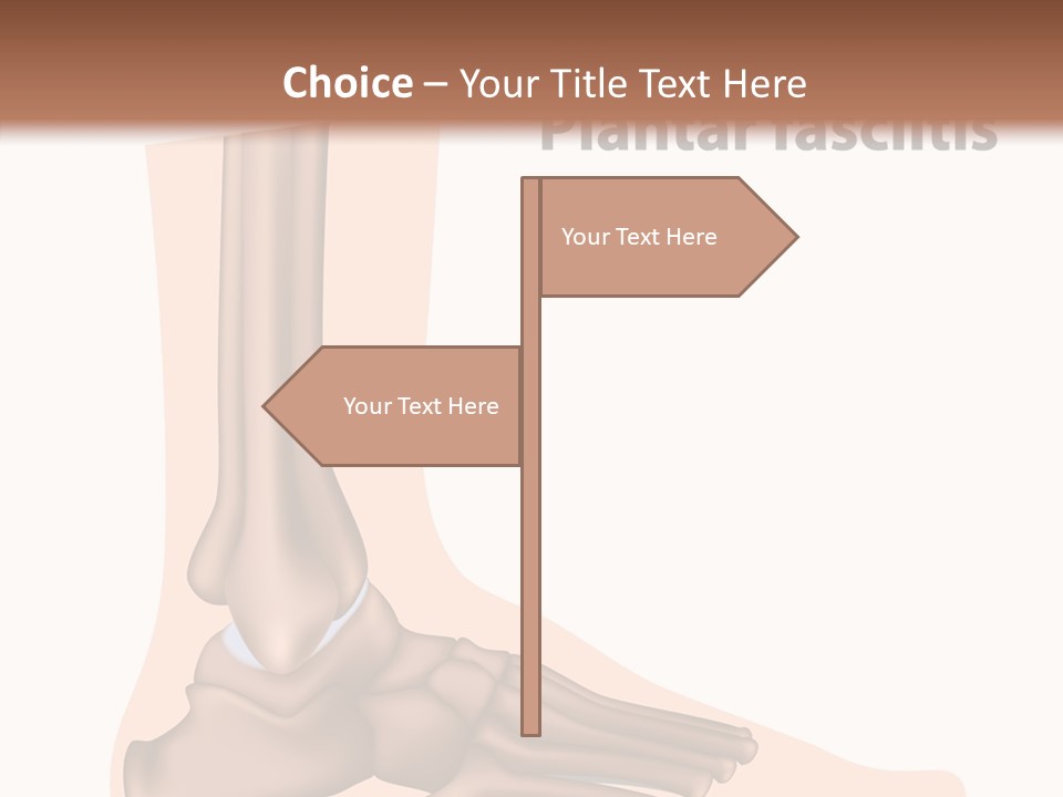 Problem Fibula Ankle PowerPoint Template