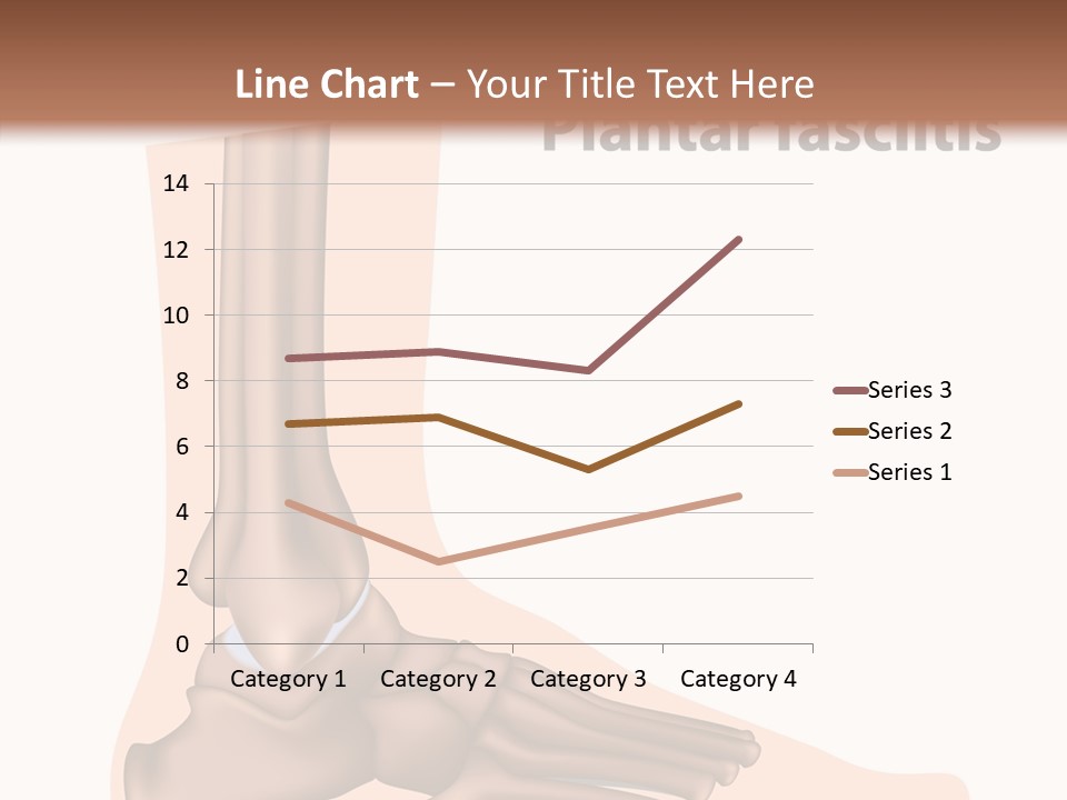 Problem Fibula Ankle PowerPoint Template