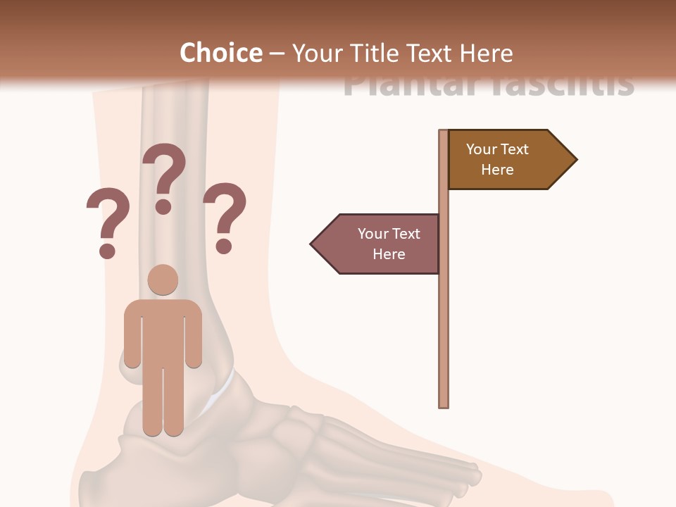 Problem Fibula Ankle PowerPoint Template