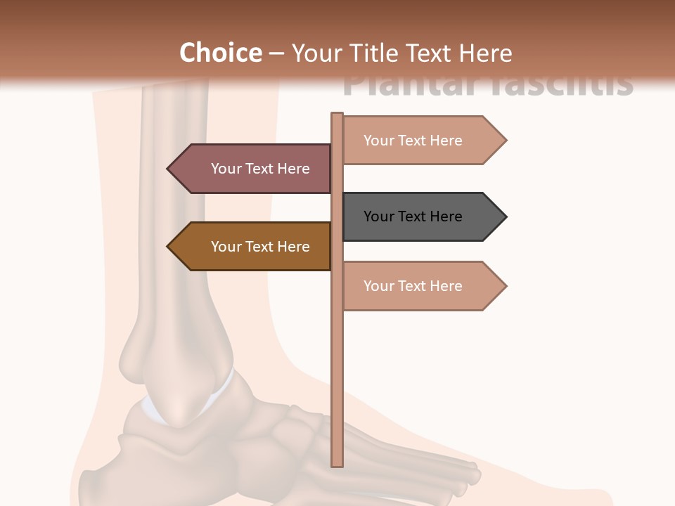 Problem Fibula Ankle PowerPoint Template
