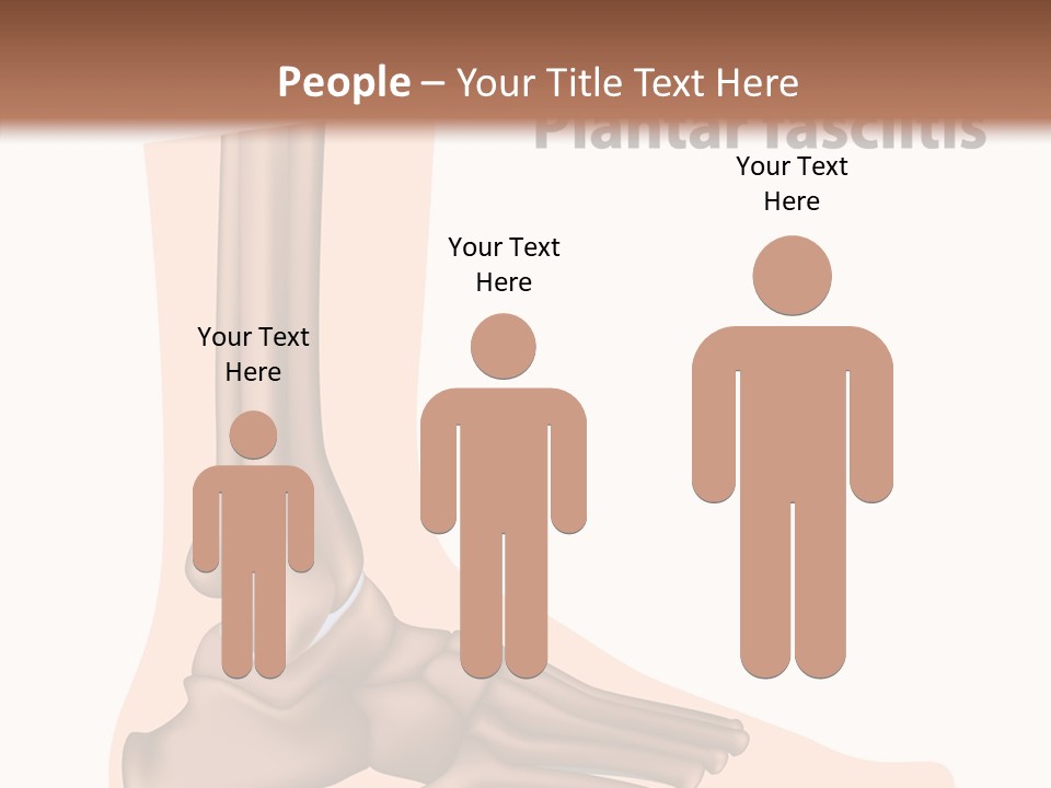 Problem Fibula Ankle PowerPoint Template