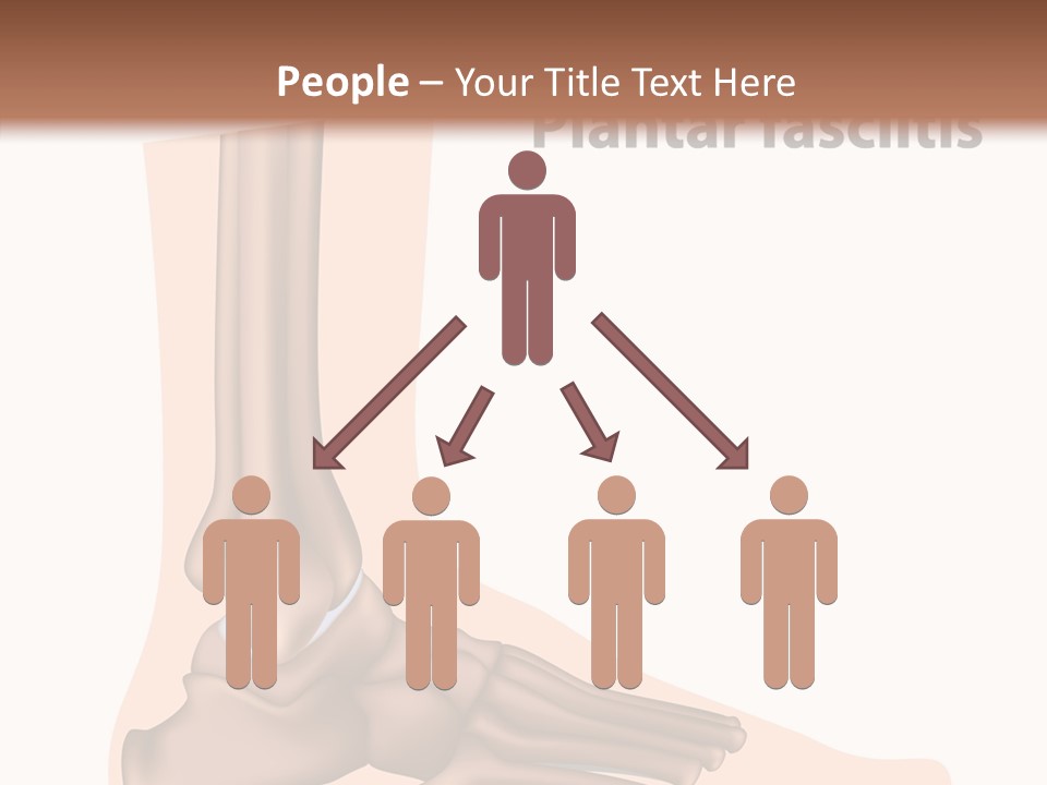 Problem Fibula Ankle PowerPoint Template