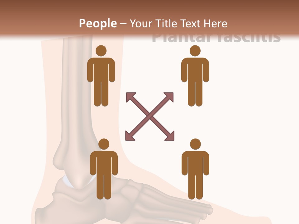 Problem Fibula Ankle PowerPoint Template