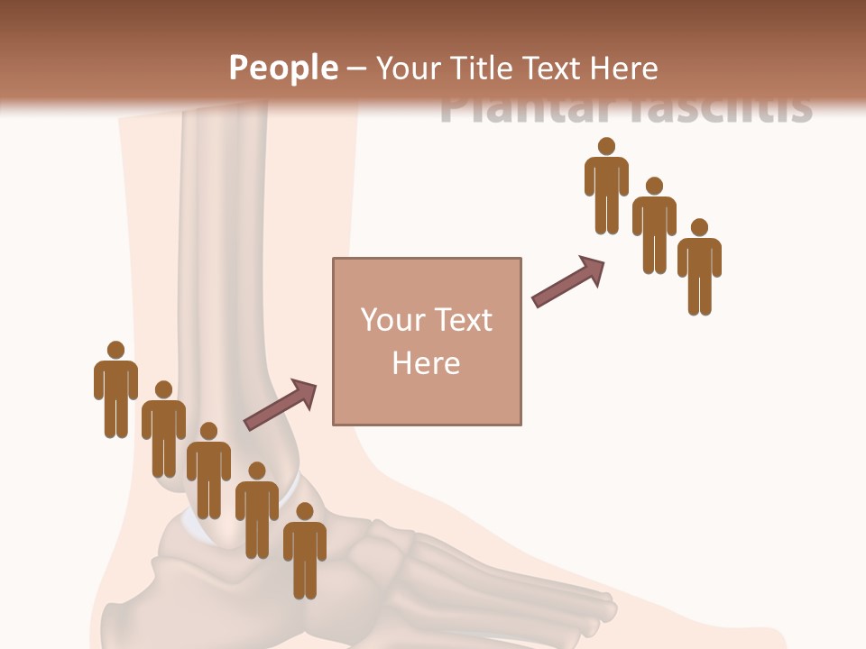 Problem Fibula Ankle PowerPoint Template