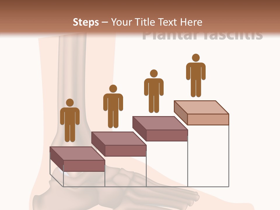 Problem Fibula Ankle PowerPoint Template