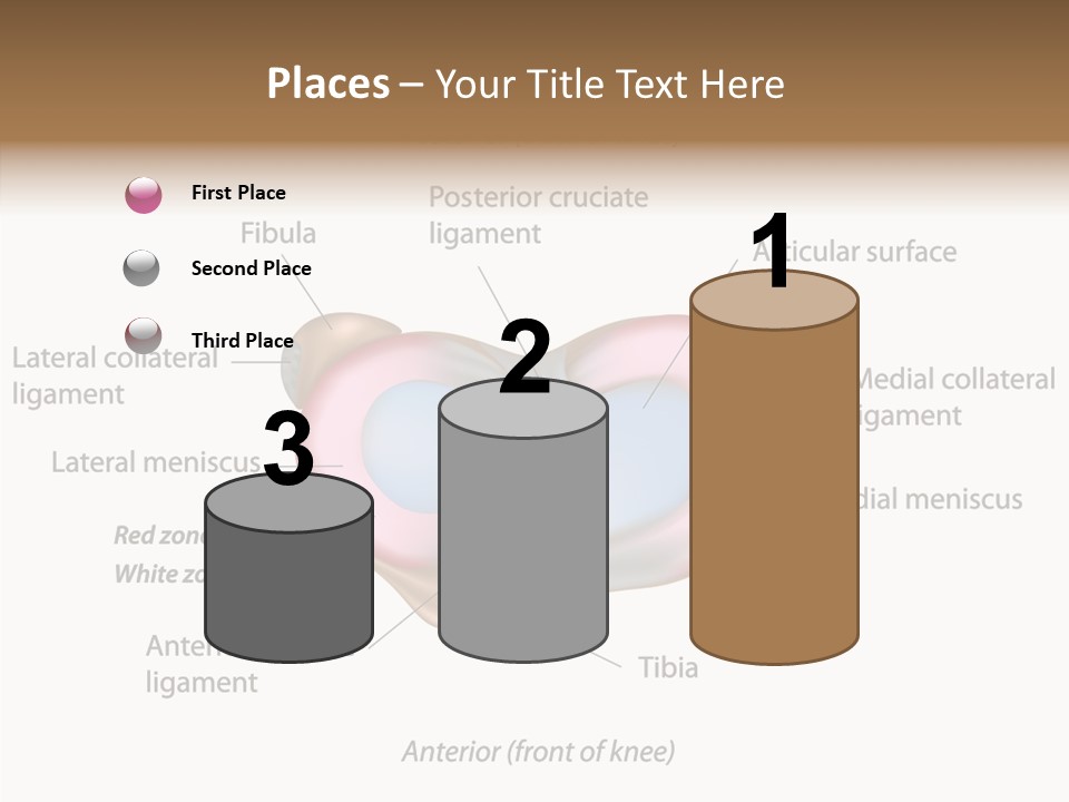 Bone Orthopedic Movement PowerPoint Template