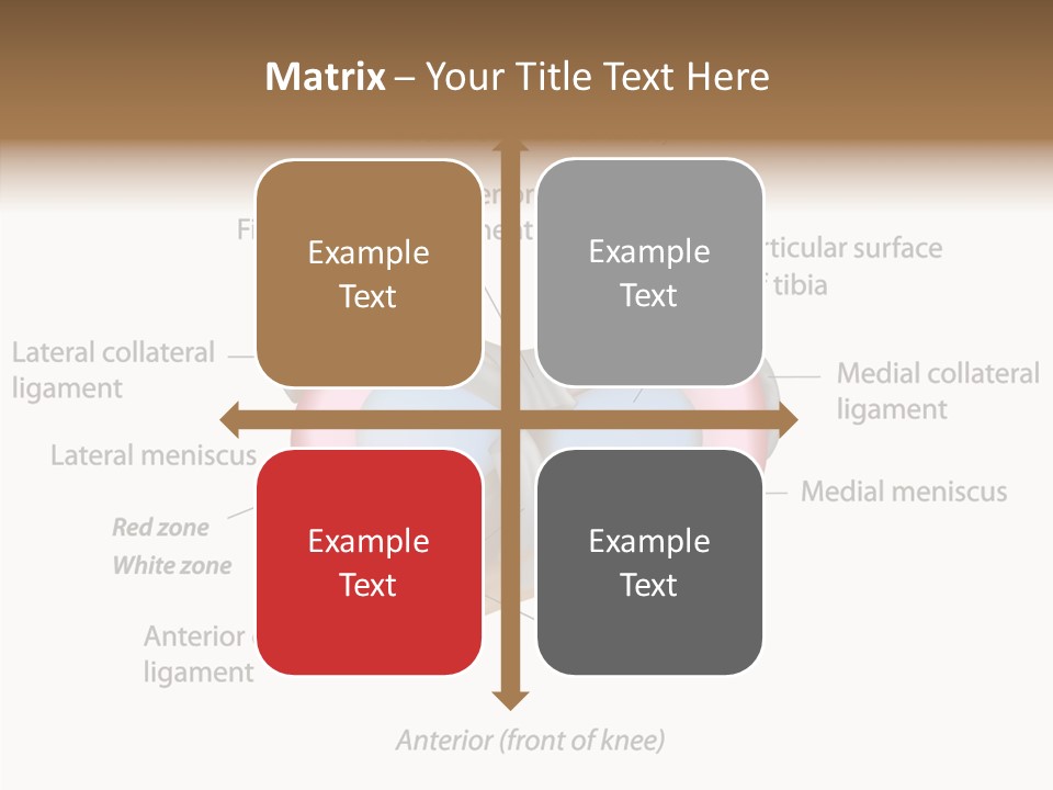 Bone Orthopedic Movement PowerPoint Template