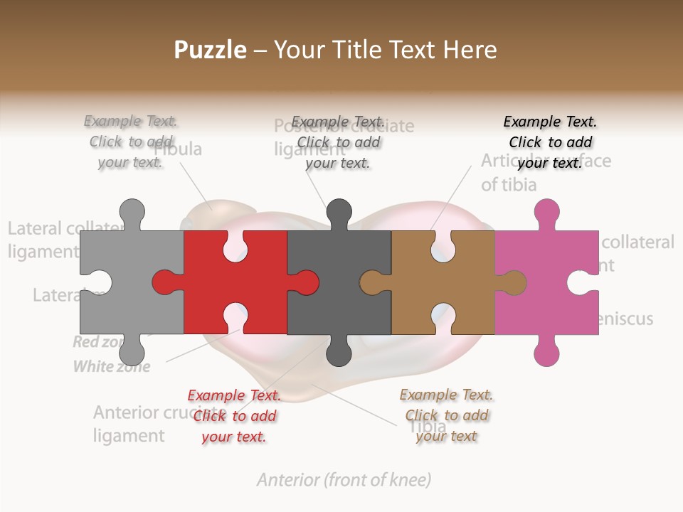 Bone Orthopedic Movement PowerPoint Template