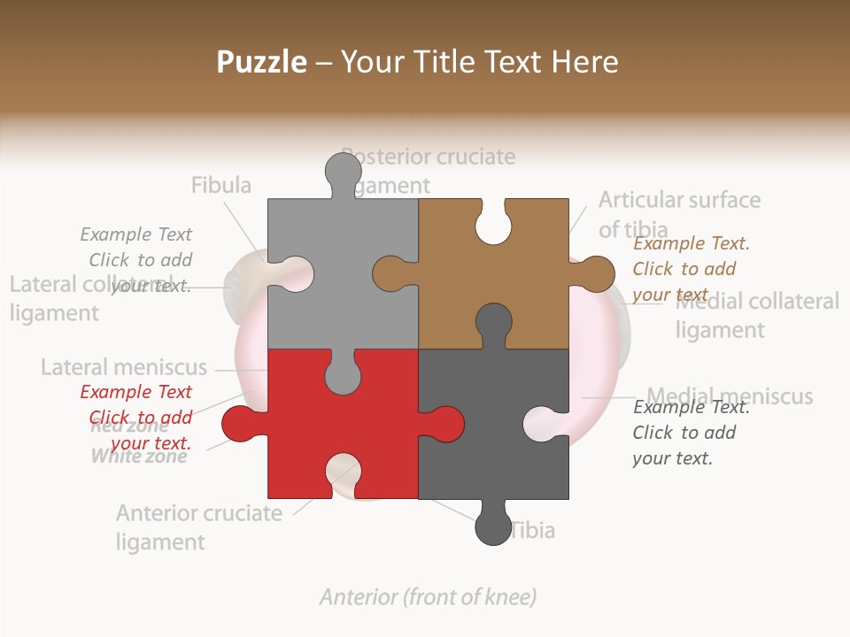 Bone Orthopedic Movement PowerPoint Template