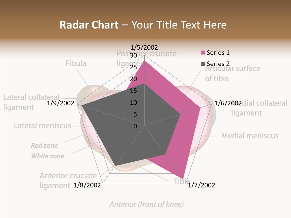 Bone Orthopedic Movement PowerPoint Template