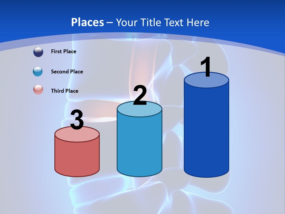 Bulging Bone Nerve PowerPoint Template