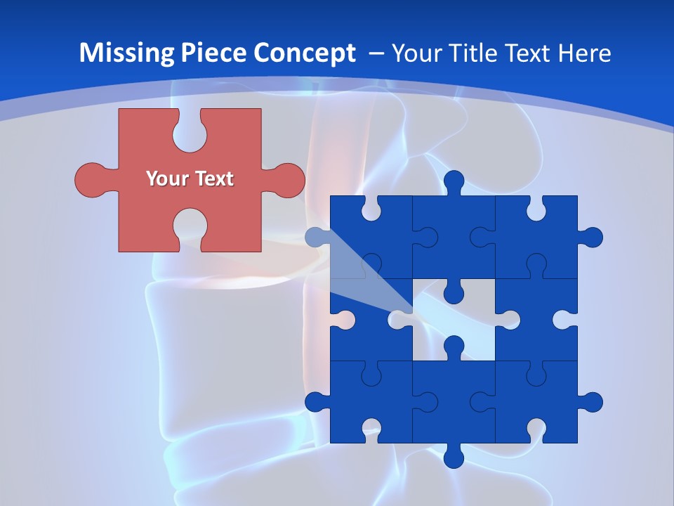 Bulging Bone Nerve PowerPoint Template