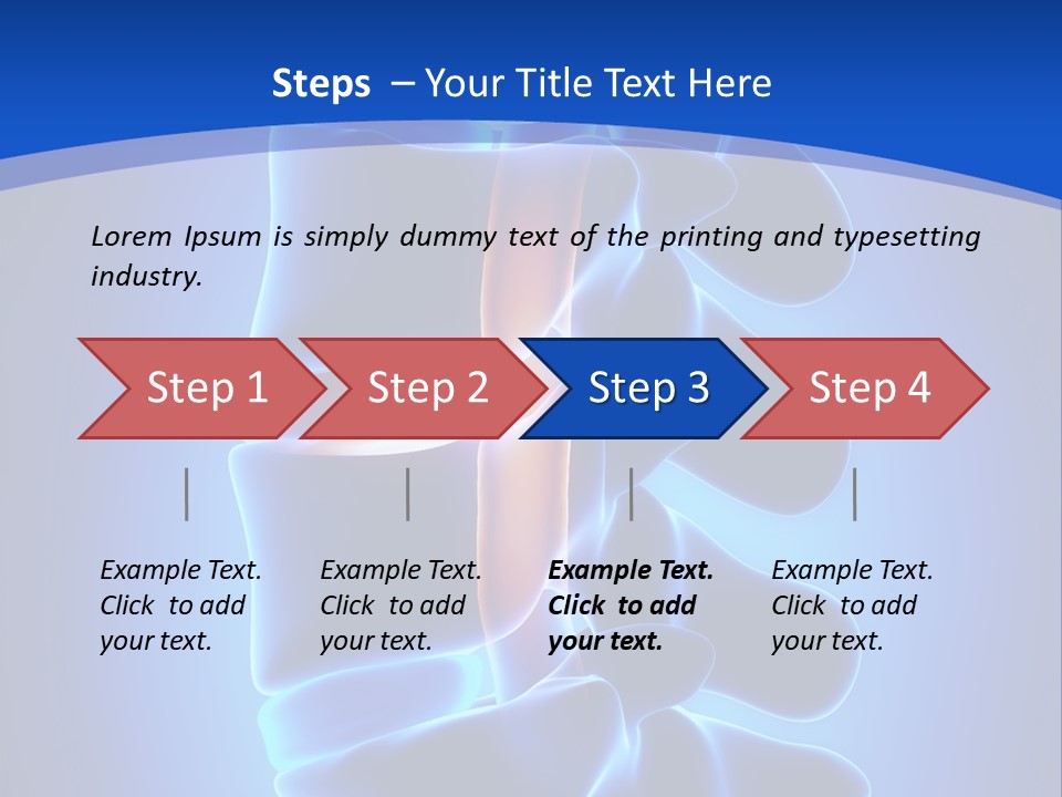 Bulging Bone Nerve PowerPoint Template