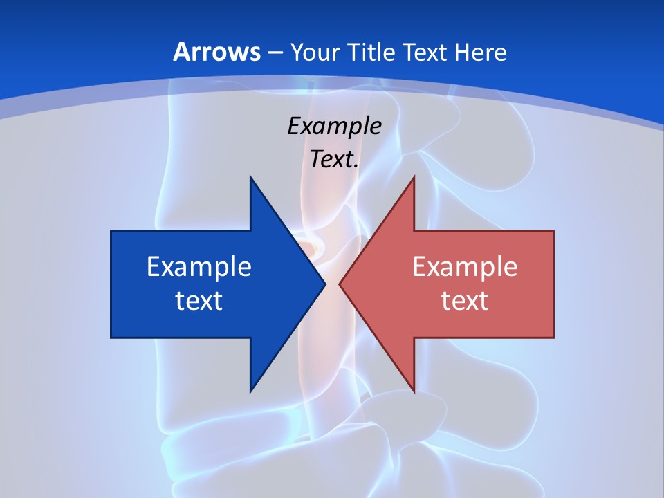 Bulging Bone Nerve PowerPoint Template