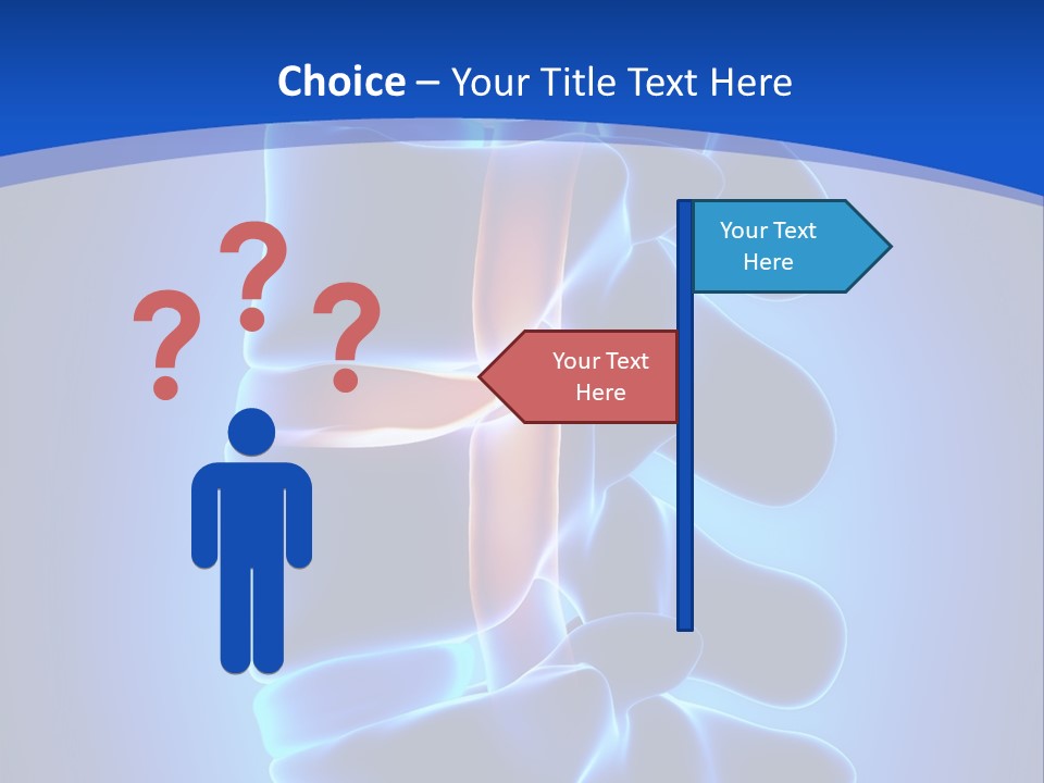 Bulging Bone Nerve PowerPoint Template