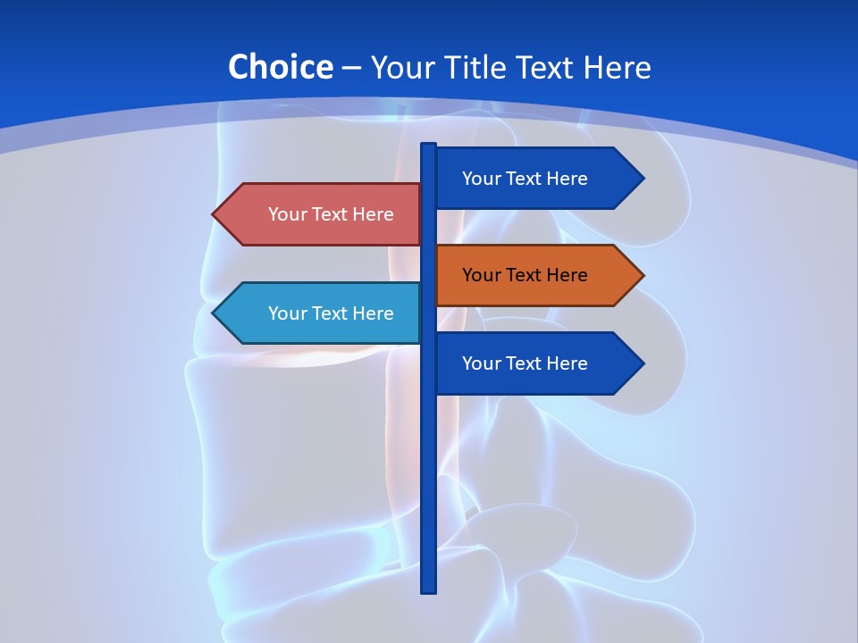 Bulging Bone Nerve PowerPoint Template