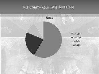 Examination Ceramic Jaw PowerPoint Template