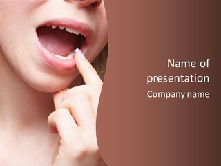 Tooth Hypersensivity Dentistry PowerPoint Template