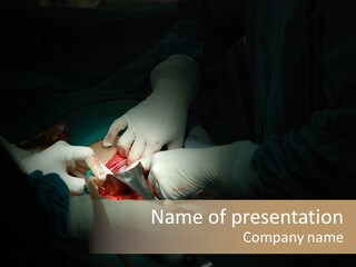 Cesarean Team Procedure PowerPoint Template