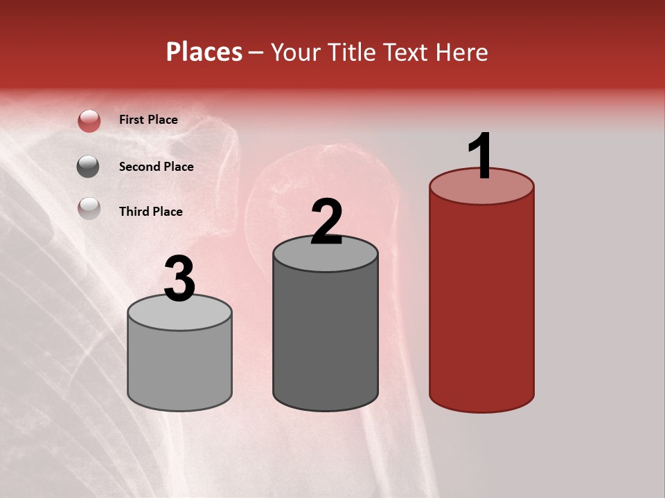Medical Injury Humeral PowerPoint Template