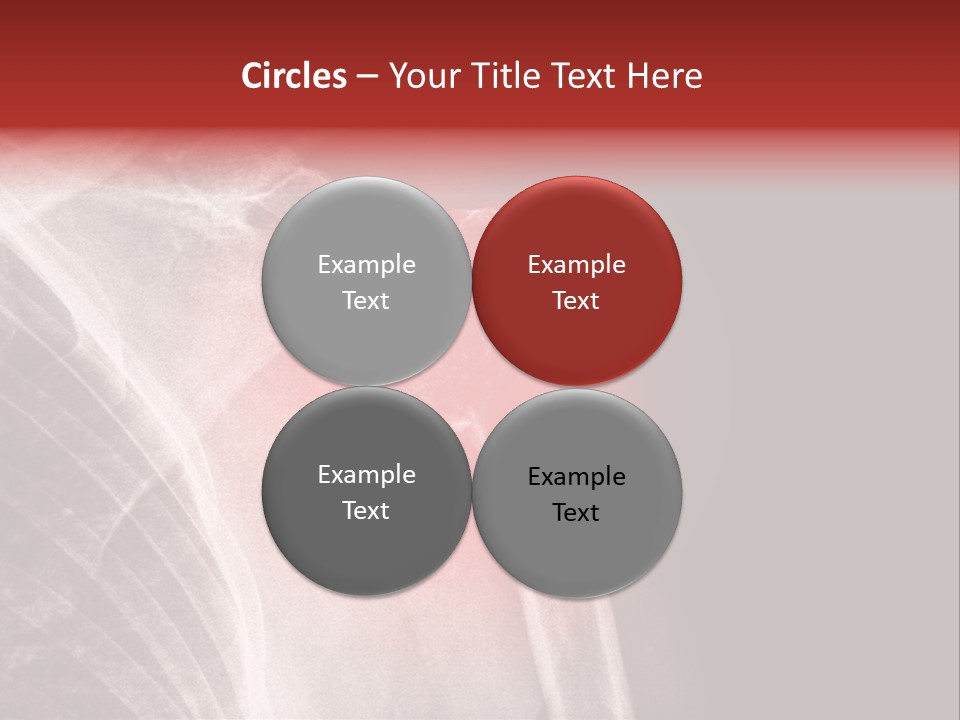 Medical Injury Humeral PowerPoint Template