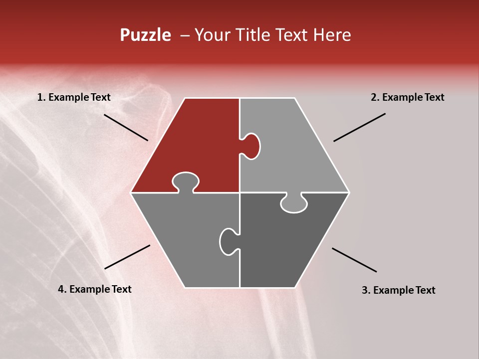 Medical Injury Humeral PowerPoint Template