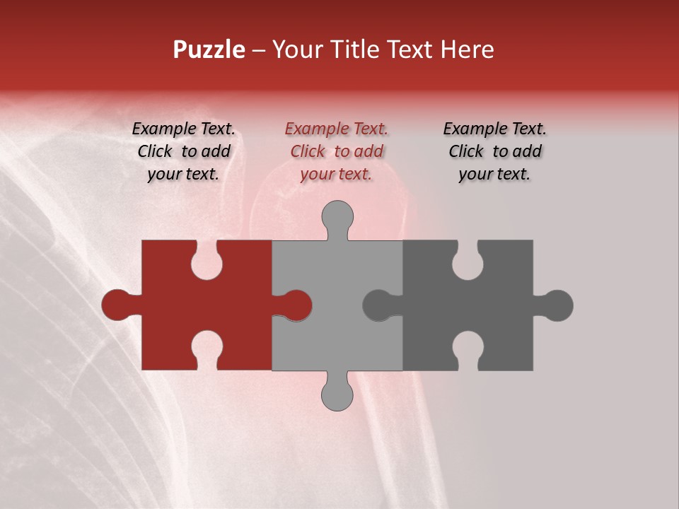 Medical Injury Humeral PowerPoint Template