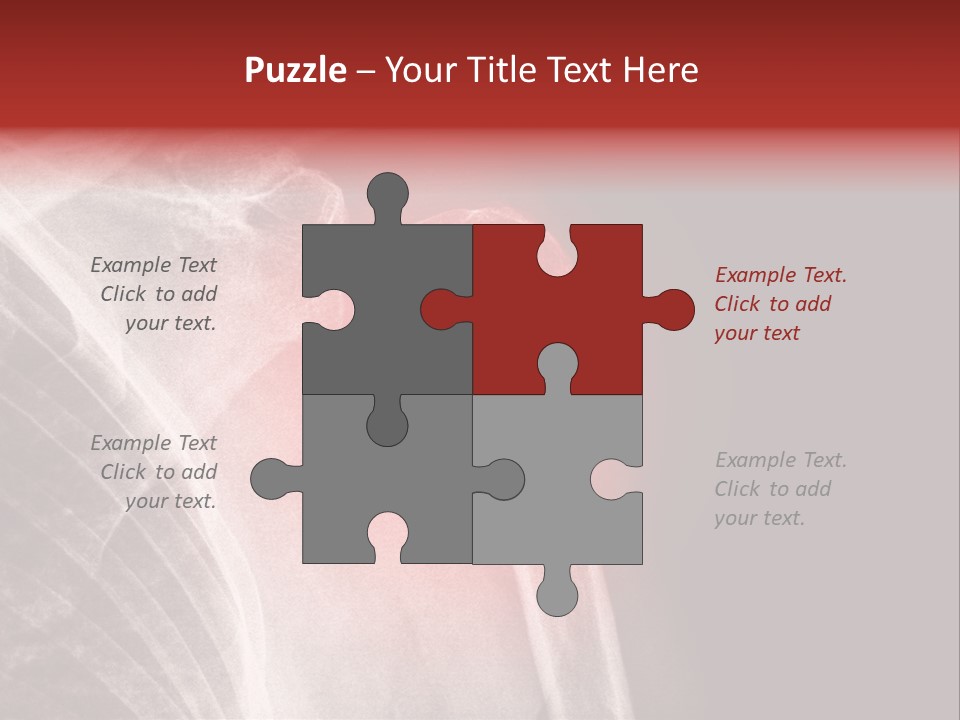 Medical Injury Humeral PowerPoint Template