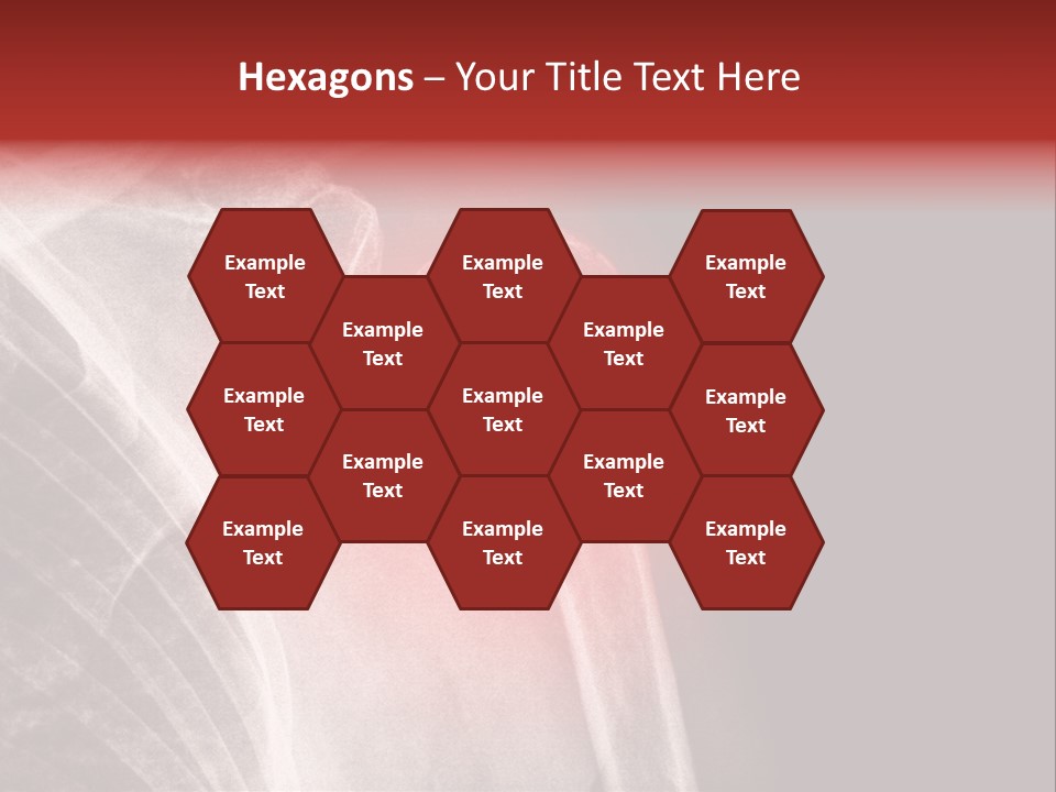 Medical Injury Humeral PowerPoint Template